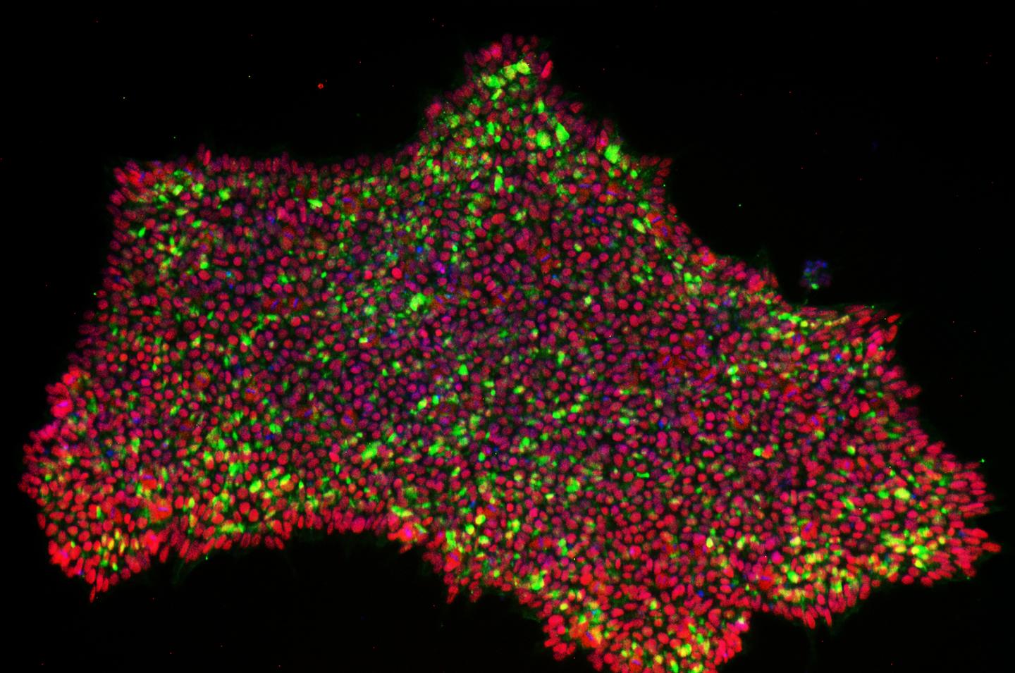 不切割DNA的CRISPR促進普通人類皮膚細胞轉化為iPSCs