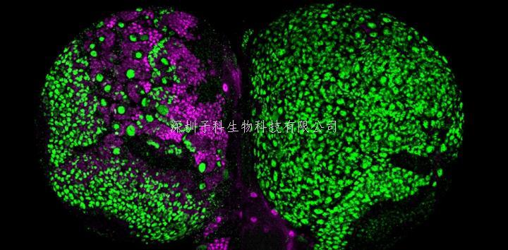 北大學(xué)者eLife發(fā)文：神經(jīng)祖細(xì)胞命運(yùn)鎖定，防止腦腫瘤發(fā)生新機(jī)制