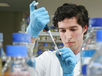 Cell Rep：c-Src通過(guò)調(diào)控糖代謝促進(jìn)腫瘤發(fā)生發(fā)展的機(jī)制